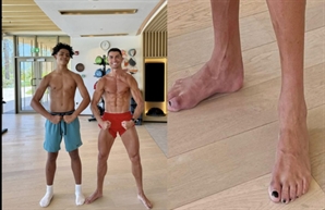 "호날두 발톱이 왜 까맣지?"…패션 아닌 생존 전략이라는 '검정 발톱' 뭐길래
