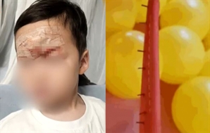 "흉터 평생 간다는데"…키즈카페 놀이기구 철심에 이마 찢긴 3세, 무슨 일?
