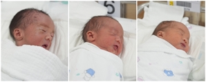 조산 위험 큰 삼둥이, 35주 3일 채우고 수술 없이 태어난 비결