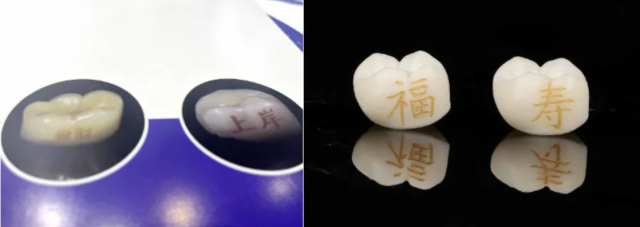 치아에 글씨를 새긴 ‘치아 문신’. 연합뉴스