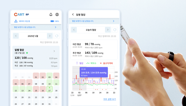 개인용 반지형 혈압계 ‘카트 비피’. 사진 제공=스카이랩스