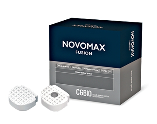 시지바이오의 척추임플란트 ‘노보맥스 퓨전’(NOVOMAX FUSION). 사진 제공=시지바이오