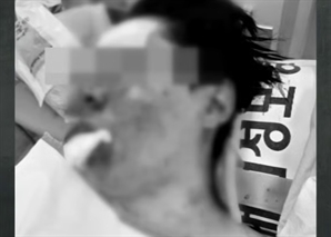 "피범벅 된 얼굴 보니 날 죽이려 했구나"…납치된 100만 유튜버 전한 끔찍한 그날