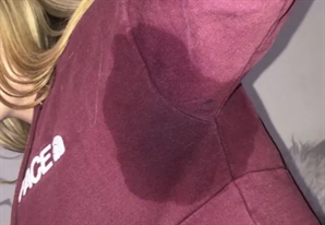 "숨만 쉬어도 겨드랑이 다 젖어"…땀 때문에 미치겠다는 20대, 치료법은