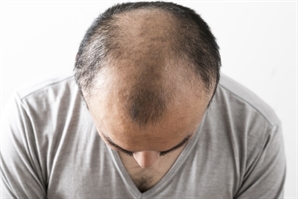 가족끼리 '이것' 돌려 썼다가 머리 다 빠져…겨울철 긴급 경고 나온 감염병, 뭐길래