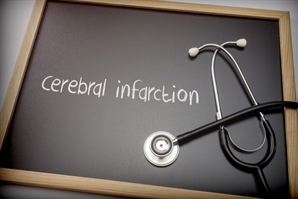 불시에 찾아오는 뇌경색…재관류술 후 ‘이차손상’ 막을 해법 찾았다[헬시타임]