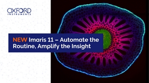 옥스포드 인스트루먼츠, 더욱 스마트해진 'Imaris 11' 출시