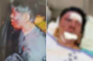 "질질 끌고가 야구 방망이로"…‘100만 유튜버’ 납치 사건 CCTV 보니