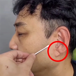 쓰러졌던 김수용 '귓불 주름'이 심근경색 전조증상?…흉부외과 교수 진단은 [건강UP]