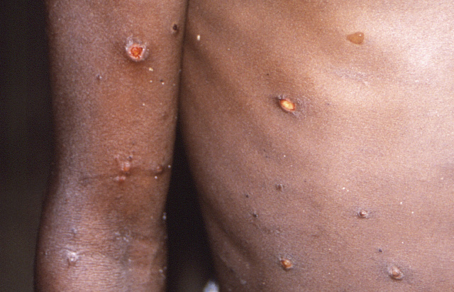 기사 내용 이해를 돕기 위한 자료사진. 클립아트코리아