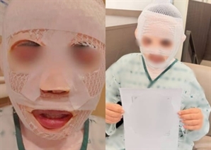 "얼굴 망가지면 다른 남자 못 만날 것"…태국인 아내에 끓는 물 부은 한국 남성